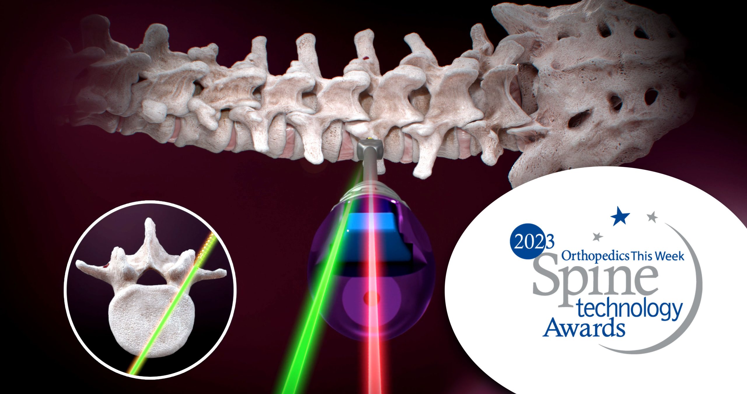 Ruthless Spine RJB FDA cleared